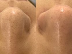 体验前-SKIN79皮肤管理中心