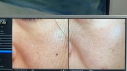 -苑苑vbeauty科技美容SPA