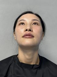 体验后-贵阳美莱医疗美容整形医院