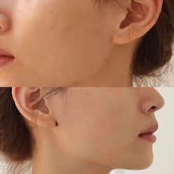 -郡艺医疗美容·微整·眼鼻吸脂