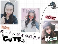 -大麦微针植发全国连锁