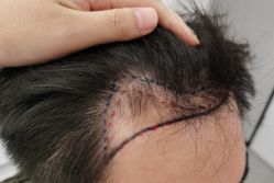 -熙朵美学植发·连锁品牌