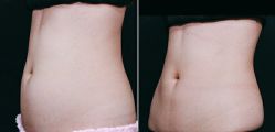 -SKINIST丽铂医疗美容