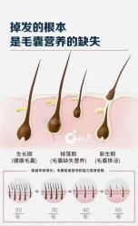 -希梵尔头皮抗衰·科技养发