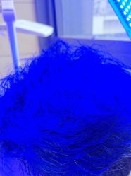 -碧莲盛·不剃发植发