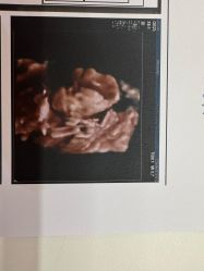 -米诺娃妇女儿童医院·三级妇儿医院