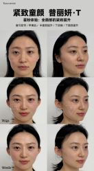 -Yestar重庆艺星医疗美容医院