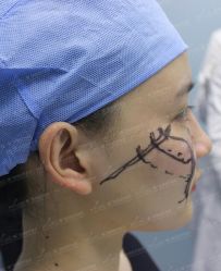 -厦门美莱整形美容医院