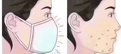 -Dr.ACNE痘院长祛痘皮肤管理全国连锁