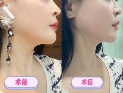 -洁铭新加坡医美