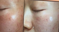 -苑苑vbeauty科技美容SPA