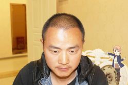 -大麦微针植发丨全国连锁