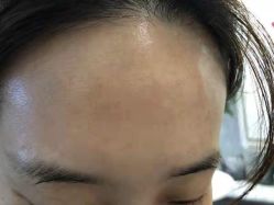 -初颜品佑肌肤管理