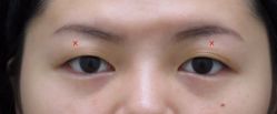 -SKINIST丽铂医疗美容