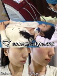 -西安壹加壹医疗美容·西北抗衰旗舰店