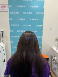 -碧莲盛·不剃发植发