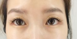 -久美荟·J Baby face