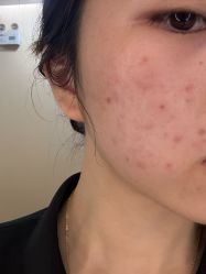 -上海玫瑰医疗美容医院