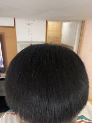 点击看大图 -熙朵美学植发连锁