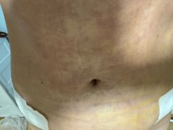 -仁爱时光·华中AI体雕·抗衰中心旗舰店