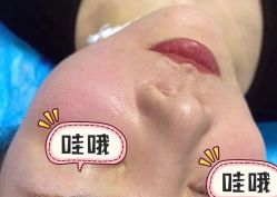 -广州曙光医学美容医院