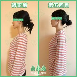 -FACE·日本小颜矫正美容整骨サロン