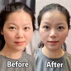 -颜和骨正·明哲式骨相美学整骨