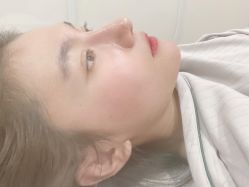 -北京米扬丽格医疗美容·联合丽格鼻整形中心