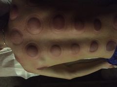 -智慧盲人按摩艾灸-颈肩腰膝疼痛调理(浦东店)