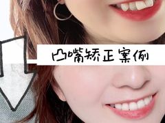 -极光口腔·矫正种植修复(锦江店)