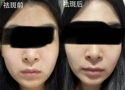 -江油茗汇整形医院