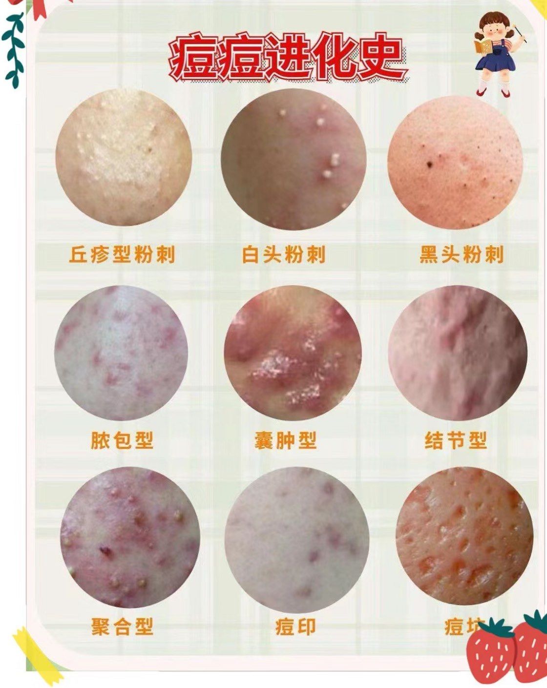 痘痘进化史,你处在哪个阶段?