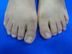 -世龙世家甲沟炎·灰指甲·嵌甲矫正·修脚(武侯区双楠店)