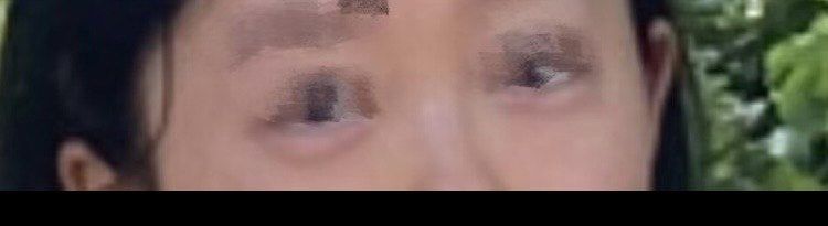 -万州华美紫馨整形美容医院