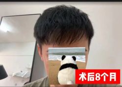 -雍禾植发全国连锁