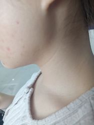 体验前-广州美莱医疗美容医院