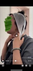 点击看大图 体验后-天津伊美尔医疗整形美容专科医院