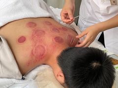 -承启堂中医馆·推拿·针灸(成华馆)