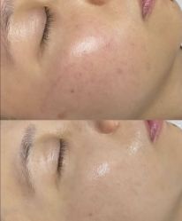 -彼家美创·量肤定制修护管理