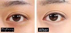 -SKINIST丽铂医疗美容