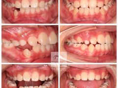 -Dr.Z dental仁康种植矫正中心