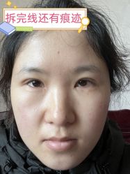 -素美医疗美容·西南眼鼻整形·修复基地