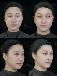 点击看大图 -Yestar重庆艺星医疗美容医院