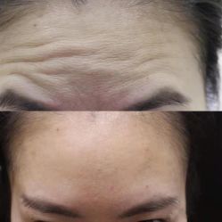 点击看大图 -上海漾颜医疗美容
