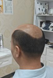 -唐风采假发补发定制