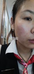 体验后-上海宏康医院·医疗美容科