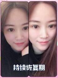 -广东韩妃整形外科医院