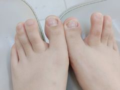 -新甲连锁灰指甲·甲沟炎·鸡眼(黑龙江路店)