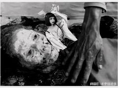 -北京市肛肠医院(北京市二龙路医院)