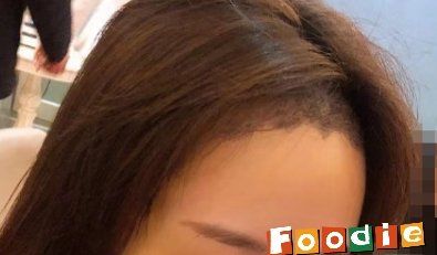 -大麦微针植发丨全国连锁